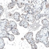 Monoclonal Anti-TET2 antibody produced in mouse Prestige Antibodies® Powered by Atlas Antibodies, clone CL6873, purified immunoglobulin, buffered aqueous glycerol solution