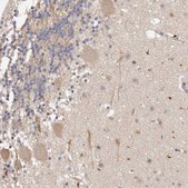 Anti-ADAMTS9 antibody produced in rabbit Prestige Antibodies® Powered by Atlas Antibodies, affinity isolated antibody, buffered aqueous glycerol solution, ab2