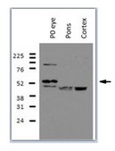 Anti-RalDH3 (ALDH1A3) from rabbit, purified by affinity chromatography