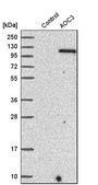 Anti-AOC3 antibody produced in rabbit Prestige Antibodies® Powered by Atlas Antibodies, affinity isolated antibody, buffered aqueous glycerol solution