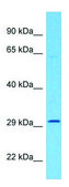 Anti-CD63 (C-terminal) antibody produced in rabbit affinity isolated antibody