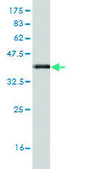 Monoclonal Anti-FZD3 antibody produced in mouse clone 2H5, purified immunoglobulin, buffered aqueous solution