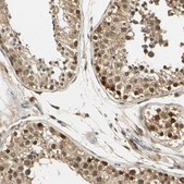 Anti-UBE2Z antibody produced in rabbit Prestige Antibodies® Powered by Atlas Antibodies, affinity isolated antibody, buffered aqueous glycerol solution