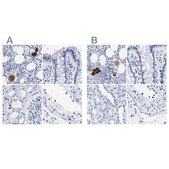 Anti-TREML1 antibody produced in rabbit Prestige Antibodies® Powered by Atlas Antibodies, affinity isolated antibody, buffered aqueous glycerol solution
