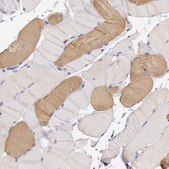 Anti-MYH6 antibody produced in rabbit Prestige Antibodies® Powered by Atlas Antibodies, affinity isolated antibody, buffered aqueous glycerol solution