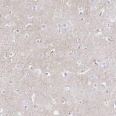 Anti-SYT1 antibody produced in rabbit Prestige Antibodies® Powered by Atlas Antibodies, affinity isolated antibody, buffered aqueous glycerol solution