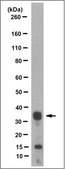 Anti-Uracil-DNA glycosylase Antibody, clone 8G10.1 clone 8G10.1, from mouse