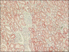 Anti-LRRK2 (C-terminal region) antibody produced in rabbit ~1.0 mg/mL, affinity isolated antibody, buffered aqueous solution