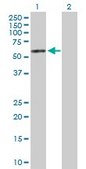 Anti-PDK4 antibody produced in rabbit purified immunoglobulin, buffered aqueous solution