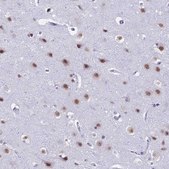 Anti-SRSF5 antibody produced in rabbit Prestige Antibodies® Powered by Atlas Antibodies, affinity isolated antibody, buffered aqueous glycerol solution