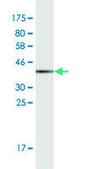 Monoclonal Anti-CRABP2 antibody produced in mouse clone 4F2, purified immunoglobulin, buffered aqueous solution