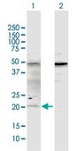 Anti-ATOH7 antibody produced in rabbit purified immunoglobulin, buffered aqueous solution