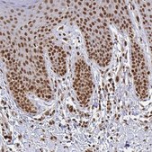 Anti-XPO1 antibody produced in rabbit Prestige Antibodies® Powered by Atlas Antibodies, affinity isolated antibody, buffered aqueous glycerol solution