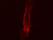 LentiBrite α-actinin-RFP Lentiviral Biosensor