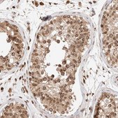 Anti-TPR antibody produced in rabbit Prestige Antibodies® Powered by Atlas Antibodies, affinity isolated antibody, buffered aqueous glycerol solution, Ab3