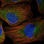 Anti-UBE2F antibody produced in rabbit Prestige Antibodies® Powered by Atlas Antibodies, affinity isolated antibody, buffered aqueous glycerol solution