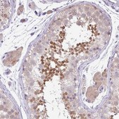 Anti-DNAL1 antibody produced in rabbit Prestige Antibodies® Powered by Atlas Antibodies, affinity isolated antibody, buffered aqueous glycerol solution