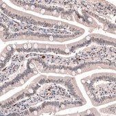 Anti-TET3 antibody produced in rabbit Prestige Antibodies® Powered by Atlas Antibodies, affinity isolated antibody, buffered aqueous glycerol solution
