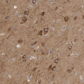 Anti-KLHL11 antibody produced in rabbit Prestige Antibodies® Powered by Atlas Antibodies, affinity isolated antibody, buffered aqueous glycerol solution