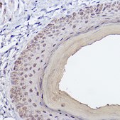 Anti-SSCA1/SerpinB3 Antibody, clone 6J3U6, Rabbit Monoclonal
