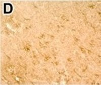 Anti-DNMT3B antibody produced in rabbit Prestige Antibodies® Powered by Atlas Antibodies, affinity isolated antibody, buffered aqueous glycerol solution