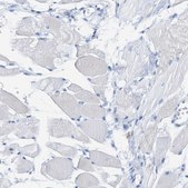 Anti-LCP1 antibody produced in rabbit Prestige Antibodies® Powered by Atlas Antibodies, affinity isolated antibody, buffered aqueous glycerol solution