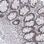 Anti-PSMB2 antibody produced in rabbit Prestige Antibodies® Powered by Atlas Antibodies, affinity isolated antibody, buffered aqueous glycerol solution, Ab2