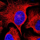 Anti-VPS25 antibody produced in rabbit Prestige Antibodies® Powered by Atlas Antibodies, affinity isolated antibody, buffered aqueous glycerol solution