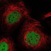 Anti-USP53 antibody produced in rabbit Prestige Antibodies® Powered by Atlas Antibodies, affinity isolated antibody, buffered aqueous glycerol solution