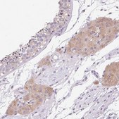 Anti-HSD17B3 antibody produced in rabbit Prestige Antibodies® Powered by Atlas Antibodies, affinity isolated antibody, buffered aqueous glycerol solution