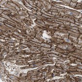 Anti-BVES antibody produced in rabbit Prestige Antibodies® Powered by Atlas Antibodies, affinity isolated antibody, buffered aqueous glycerol solution
