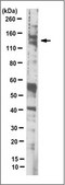 Anti-Tankyrase-1/TNKS Antibody, clone 7D1.2 clone 7D1.2, from mouse