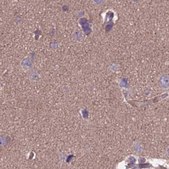 Anti-DUS2 antibody produced in rabbit Prestige Antibodies® Powered by Atlas Antibodies, affinity isolated antibody, buffered aqueous glycerol solution