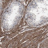 Anti-COL6A2 antibody produced in rabbit affinity isolated antibody, buffered aqueous glycerol solution