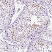 Anti-PHF7 antibody produced in rabbit Prestige Antibodies® Powered by Atlas Antibodies, affinity isolated antibody, buffered aqueous glycerol solution