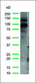 Anti-EZH2 antibody, Rabbit monoclonal recombinant, expressed in proprietary host, clone SP129, affinity isolated antibody
