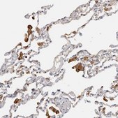 Anti-TFRC antibody produced in rabbit Prestige Antibodies® Powered by Atlas Antibodies, affinity isolated antibody, buffered aqueous glycerol solution