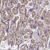 Anti-WASF2 antibody produced in rabbit Prestige Antibodies® Powered by Atlas Antibodies, affinity isolated antibody, buffered aqueous glycerol solution