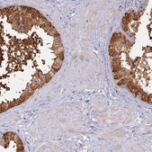 Anti-SFT2D2 antibody produced in rabbit Prestige Antibodies® Powered by Atlas Antibodies, affinity isolated antibody, buffered aqueous glycerol solution