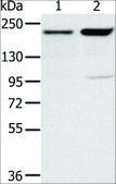 Anti-KDM5A antibody produced in rabbit affinity isolated antibody
