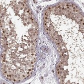 Anti-NR2C1 antibody produced in rabbit Prestige Antibodies® Powered by Atlas Antibodies, affinity isolated antibody