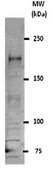 ChIPAb+ REST - ChIP Validated Antibody and Primer Set from rabbit