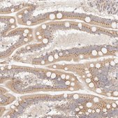 Anti-FAM20B antibody produced in rabbit Prestige Antibodies® Powered by Atlas Antibodies, affinity isolated antibody, buffered aqueous glycerol solution