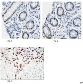 Anti-KLF4 Antibody, clone 1E6 ascites fluid, clone 1E06, from mouse