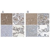 Anti-LPCAT1 antibody produced in rabbit Prestige Antibodies® Powered by Atlas Antibodies, affinity isolated antibody, buffered aqueous glycerol solution, Ab2
