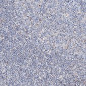 Anti-ALDH6A1 antibody produced in rabbit Prestige Antibodies® Powered by Atlas Antibodies, affinity isolated antibody, buffered aqueous glycerol solution, ab1