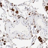 Anti-CTSH antibody produced in rabbit Prestige Antibodies® Powered by Atlas Antibodies, affinity isolated antibody, buffered aqueous glycerol solution