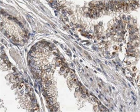 Anti-LTBP-3 Antibody from rabbit, purified by affinity chromatography