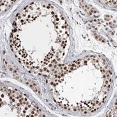 Anti-DMTF1 antibody produced in rabbit Prestige Antibodies® Powered by Atlas Antibodies, affinity isolated antibody, buffered aqueous glycerol solution