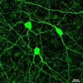 Anti-Vesicular Nucleotide Transporter (VNUT Antibody) serum, from guinea pig